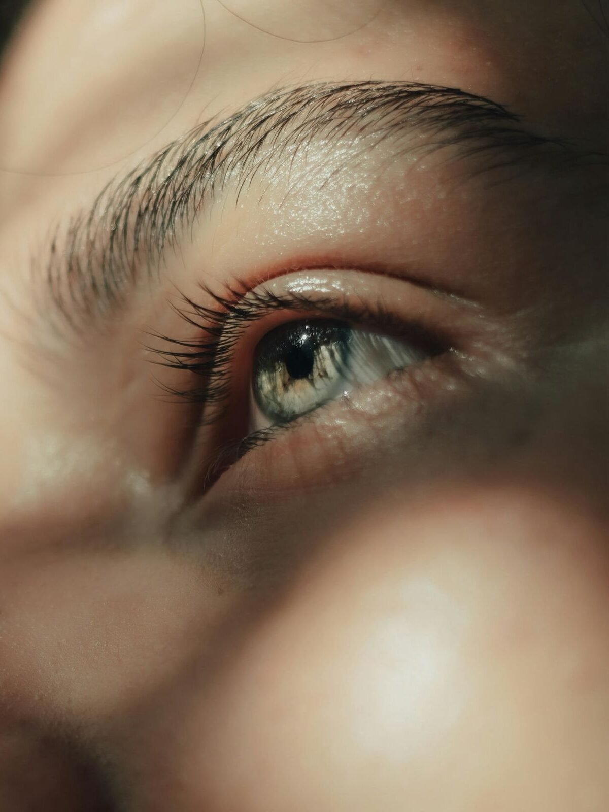 Olhos (Antes)